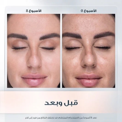 كريم النهار المضاد للتصبغات  مع 30% حماية من اشعة الشمس - من يوسرين