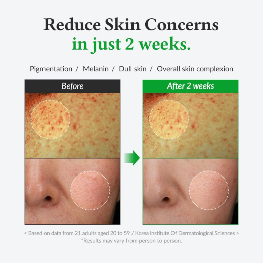 سيروم فيتامين سي 20%  لتفتيح البشرة لطيف على البشرة الحساسة-  من دكتور الثيا