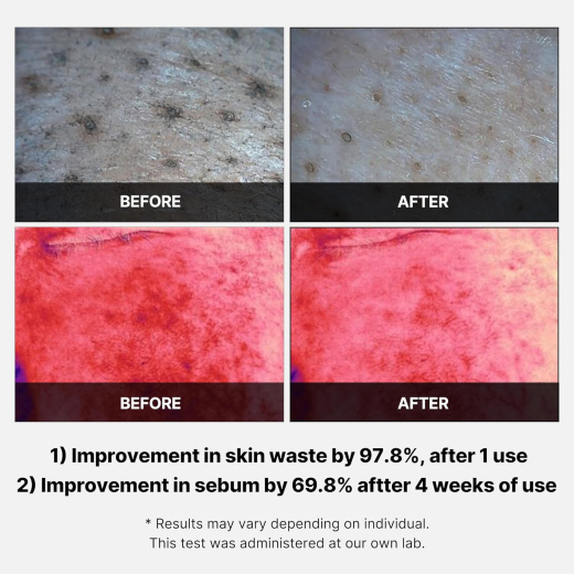 مسحات قطنية للتقشير بحمض السكسينيك والبانثينول الأحمر - من ميديكيوب