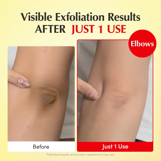 تونر فيتامين C و نياسيناميد  لإشراقة وتفتيح البشرة - من ايكوال بيري