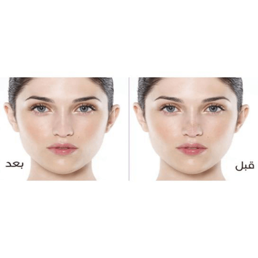لصقات الانف - من كيلان